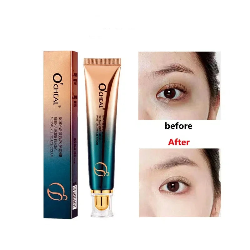 Retinol Eye Cream Moisturizing Firming Eye Skin Nourishing Reduce Fine Lines Black Circles Hydrating Cosmetics Makeup