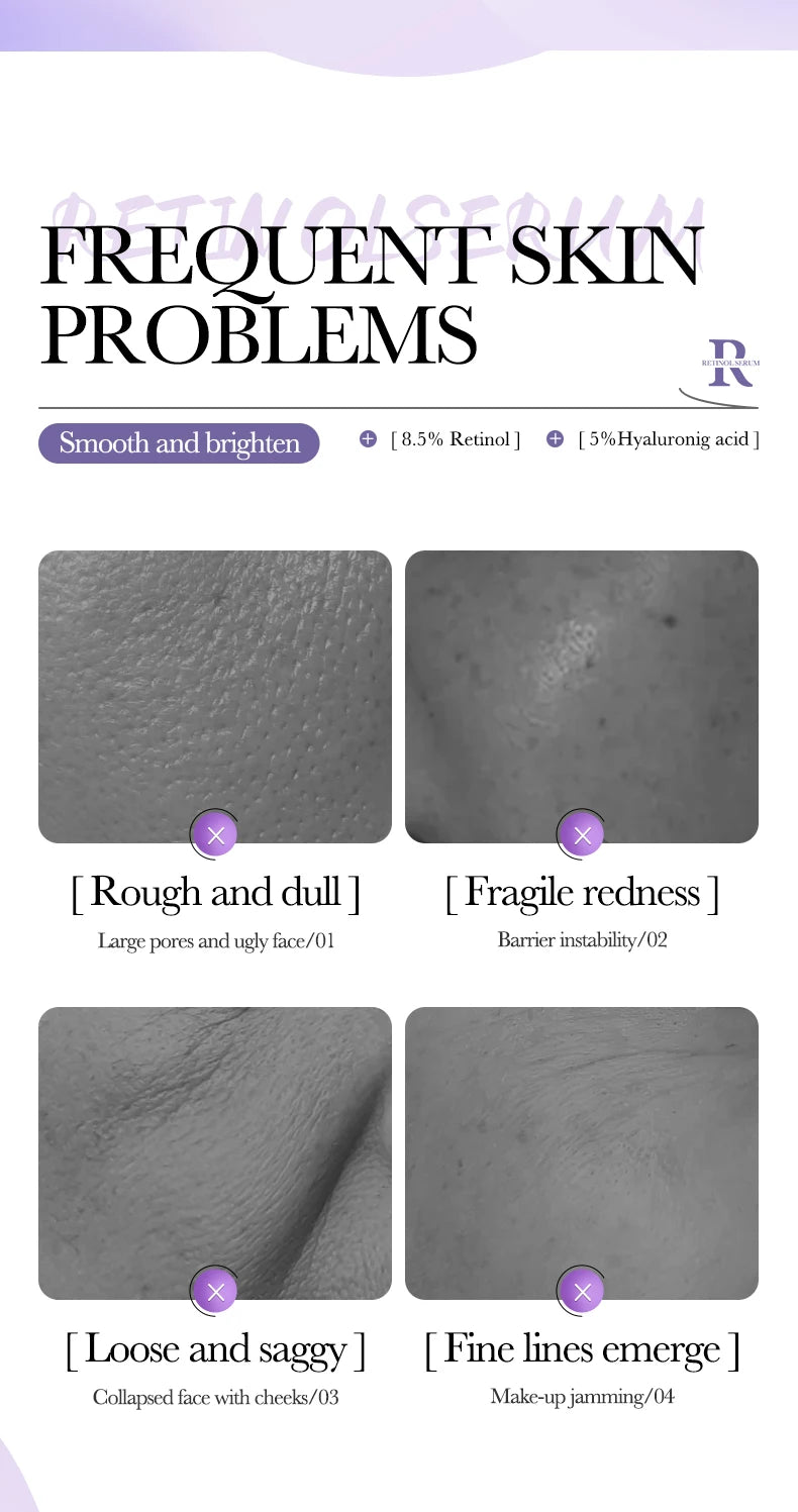 BIOAQUA Vitamin C Retinol Hyaluronic Acid Serum Moisturizing Brightening Hydrating Firming Facial Essence Beauty Face Skin Care